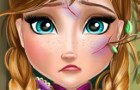 Juego Curar a Anna de Frozen